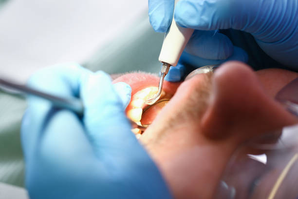 Best Dentist for Severe Toothache  in Moyie Springs, ID
